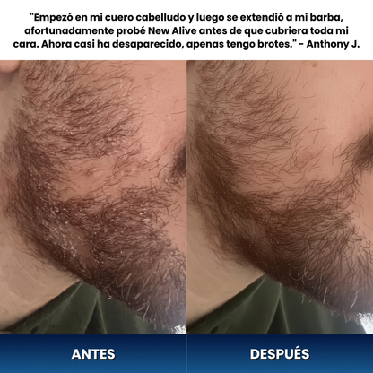 Crema Anticaspa para Barba y Cuero Cabelludo